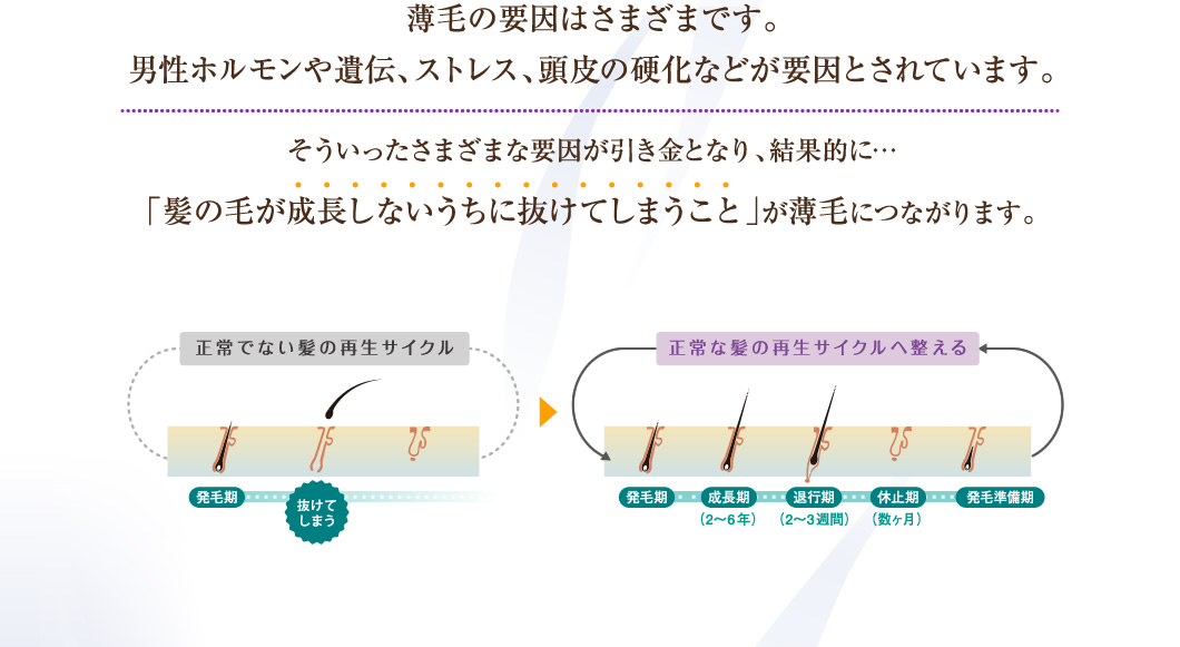 薄毛の要因はさまざまです。男性ホルモンや遺伝、ストレス、頭皮の硬化などが要因とされています。そういったさまざまな要因が引き金となり、結果的に…「髪の毛が成長しないうちに抜けてしまうこと」が薄毛につながります。